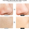 ReviveGlow 4 in 1 Pore Cleansing Spatula ATHLEXES