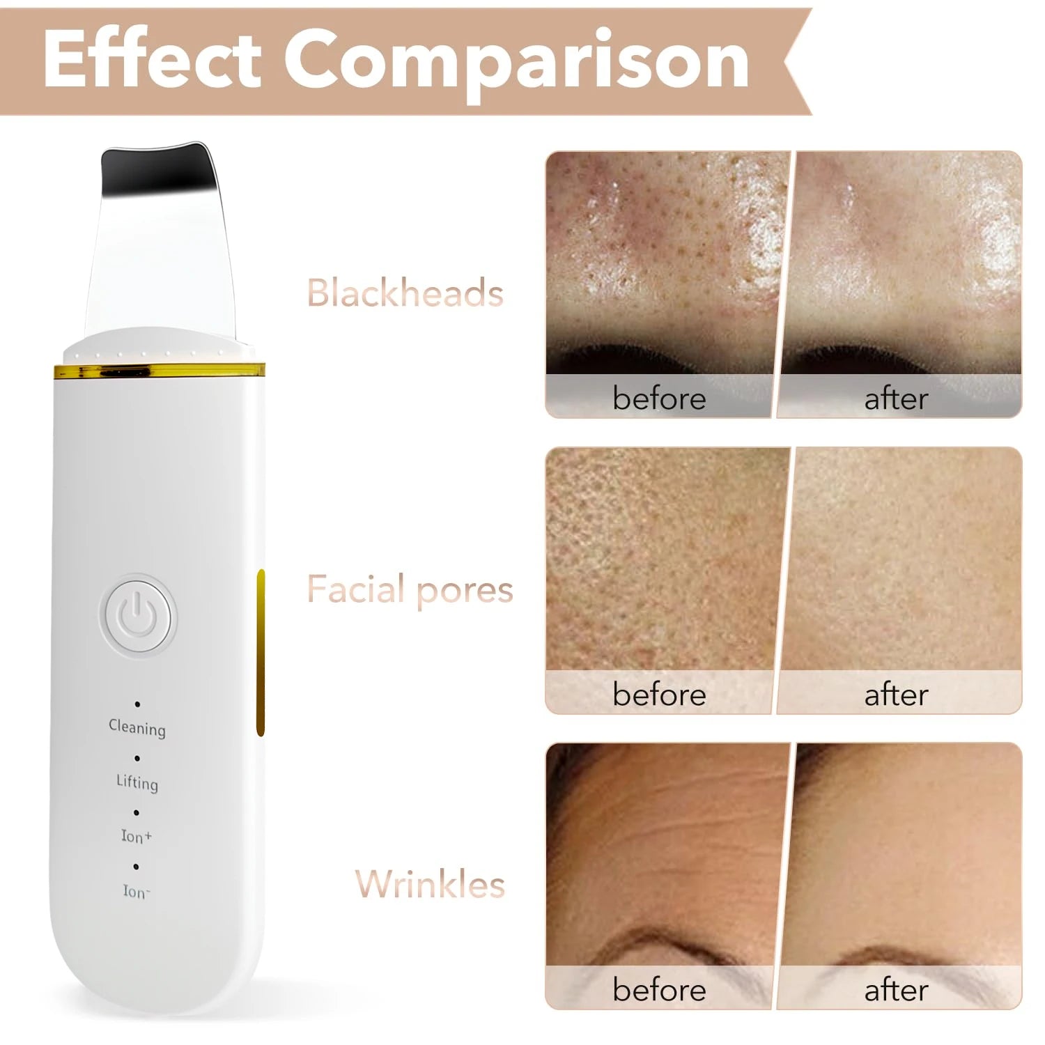 GlowLift Electric Facial Scrubber ATHLEXES