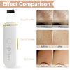 GlowLift Electric Facial Scrubber ATHLEXES