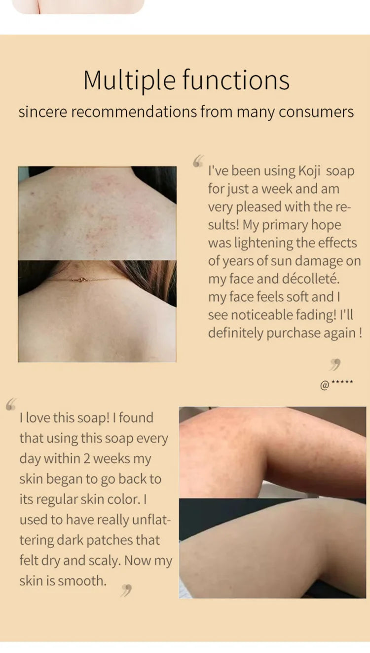 Kojic Radiance Handmade Whitening Soap ATHLEXES