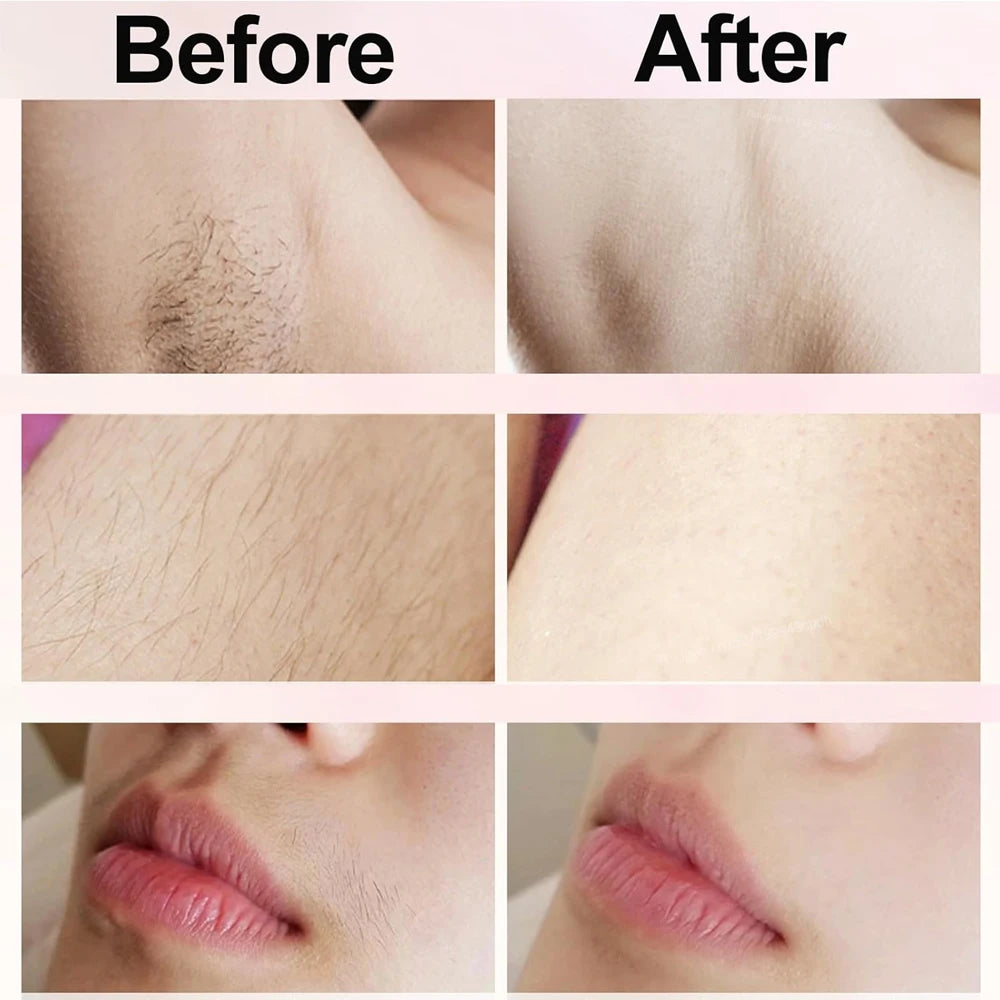 SilkSmooth 2 in 1 Painless Hair Trimmer ATHLEXES