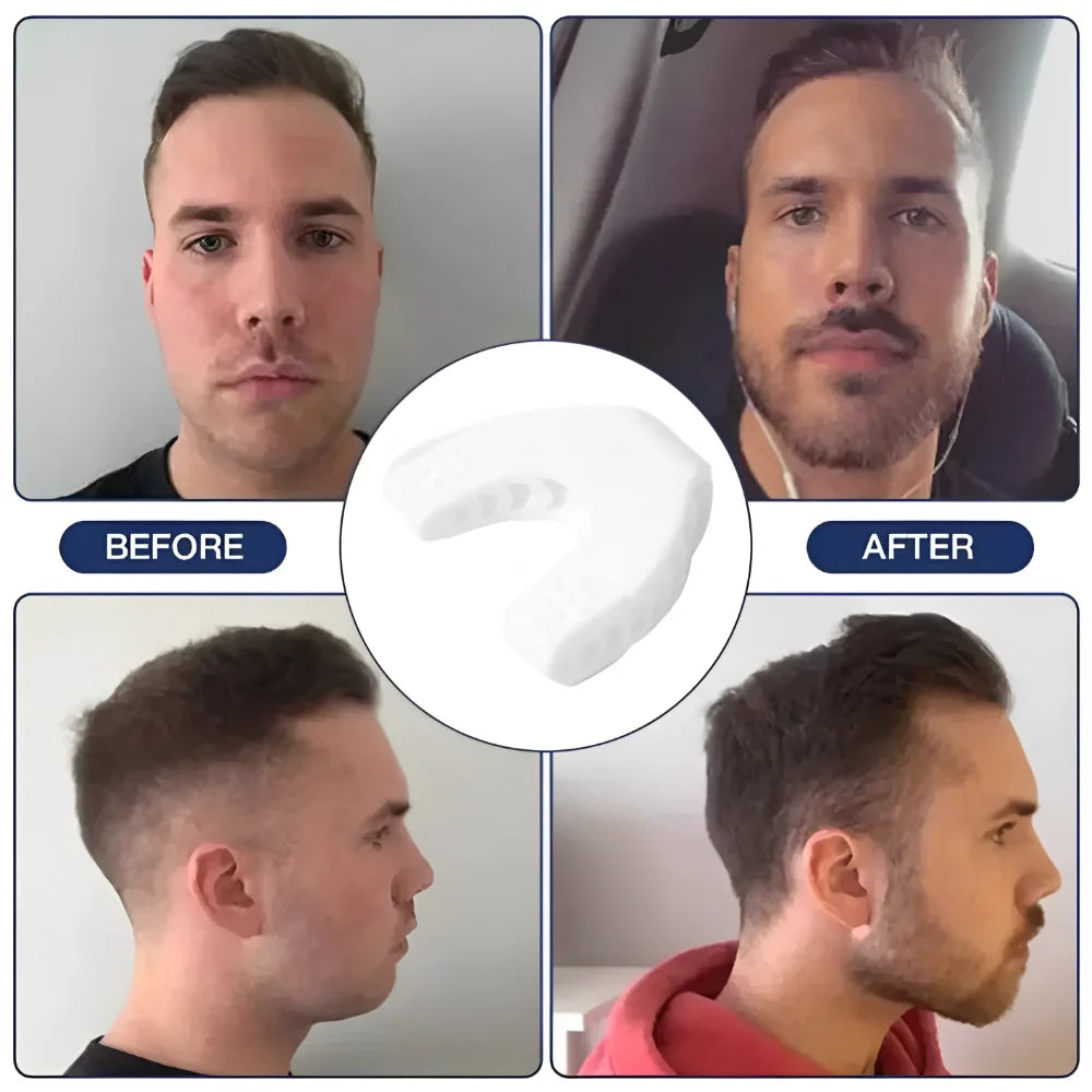 Jawline Sculpt U Shape Exerciser for Men and Women ATHLEXES